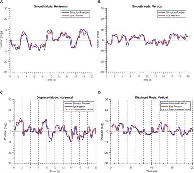 Patients Prefer a Virtual Reality Approach Over a Similarly Performing Screen-Based Approach for Continuous Oculomotor-Based Screening of Glaucomatous and Neuro-Ophthalmological Visual Field Defects